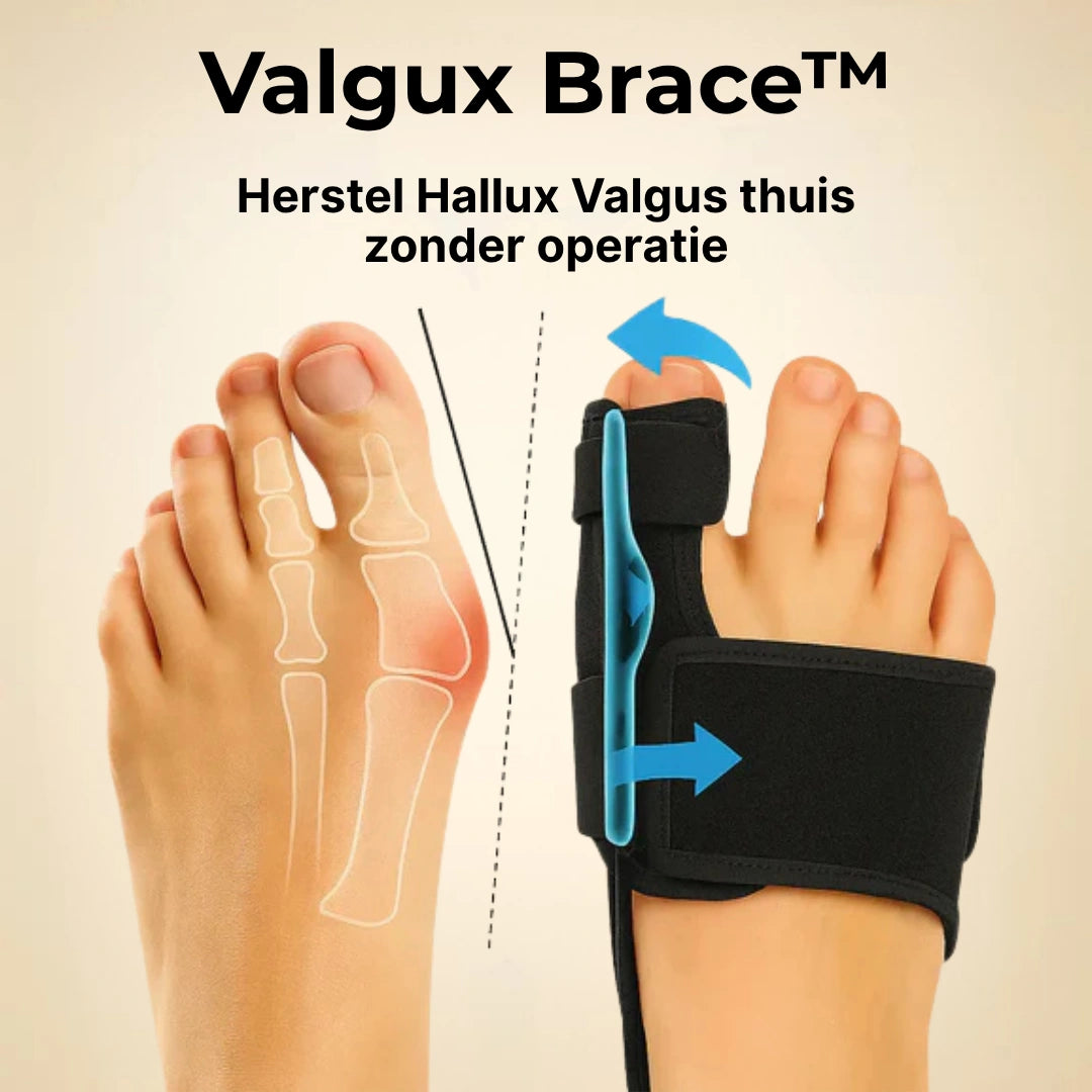 Valgux™ Brace | Teencorrector bij scheefstand (Hallux Valgus)